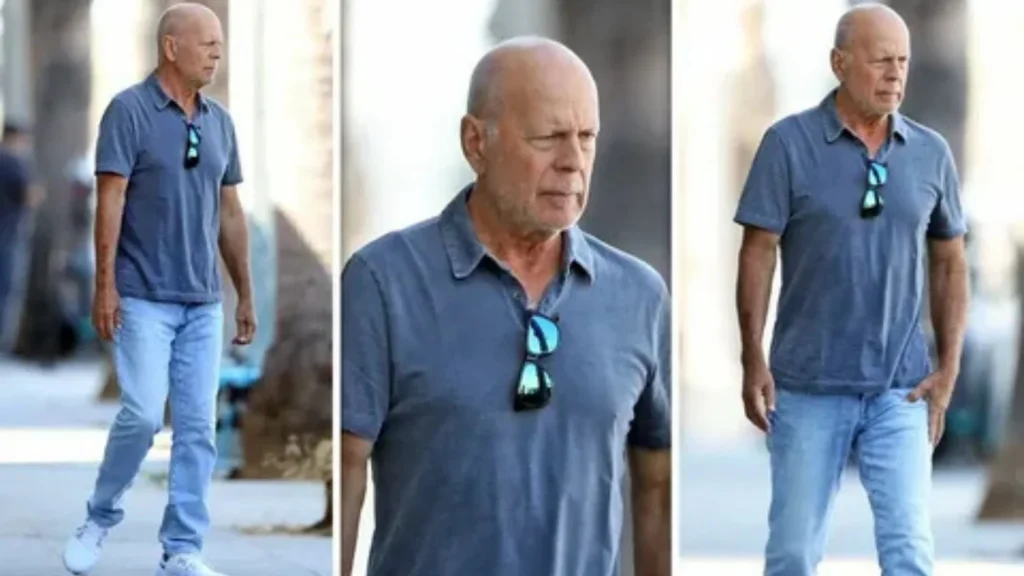 🧠 Bruce Willis Disease